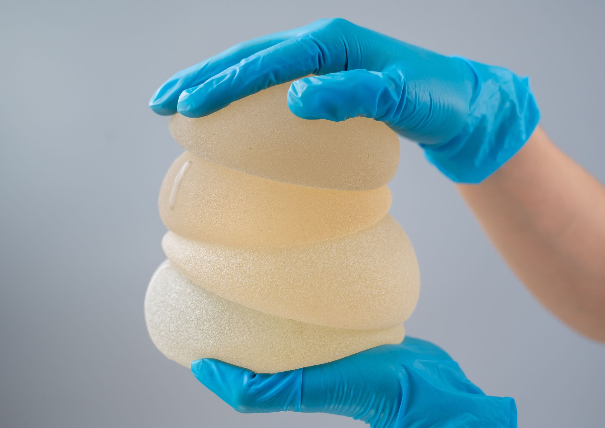 Si te operas el pecho en Sabadell usa los mejores implantes