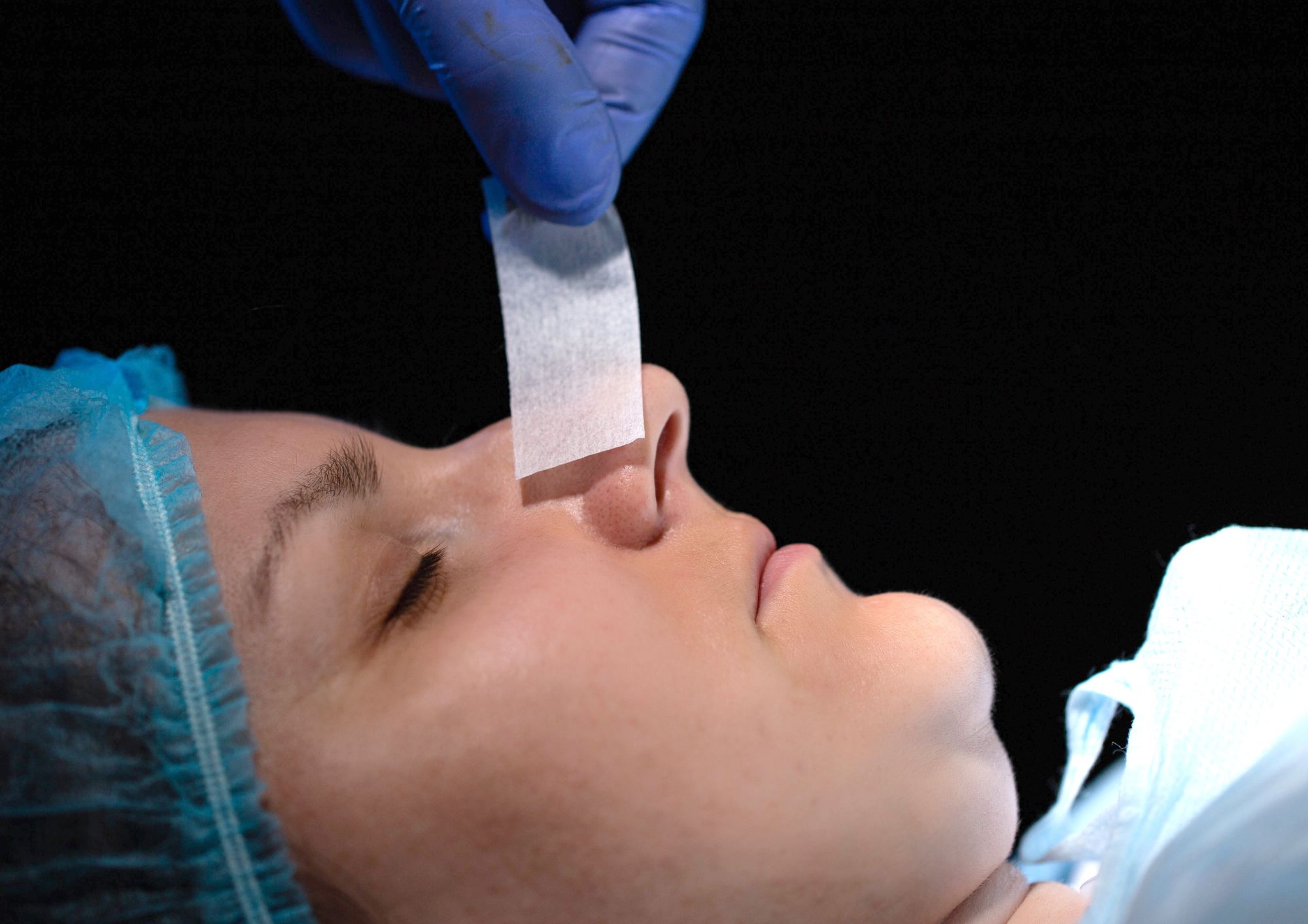 Rinoplastia en Sabadell verás la mejor opción para ti