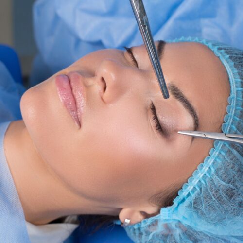 Blefaroplastia Sabadell (2)