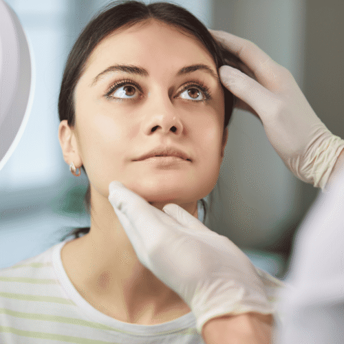 rinoplastia sin cicatriz en Sabadell (3)