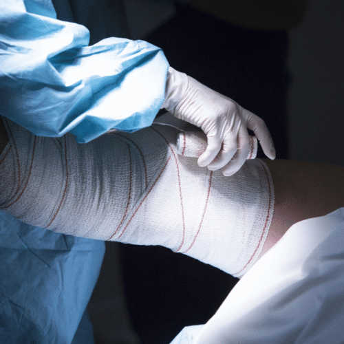 cirugía plástica de rodilla en Sabadell