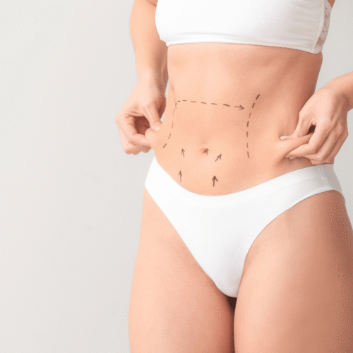 operación estética de barriga en Terrassa