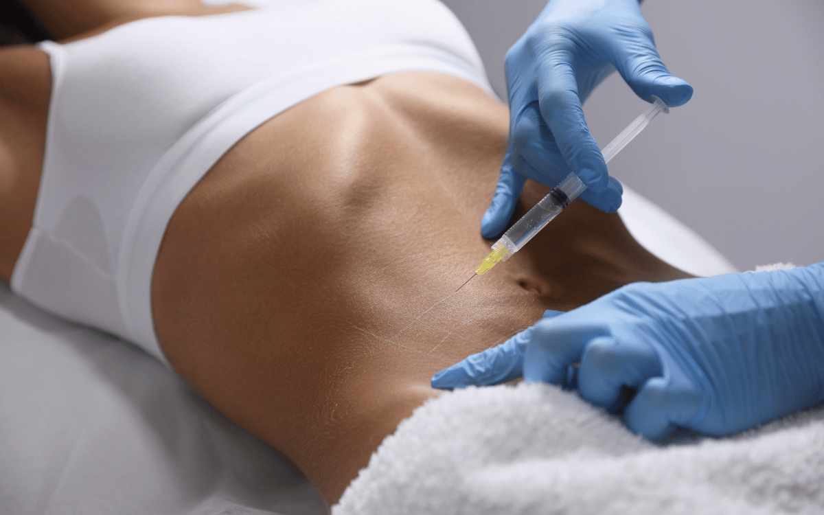 operación estética de barriga